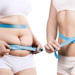 non surgical weight loss procedure
