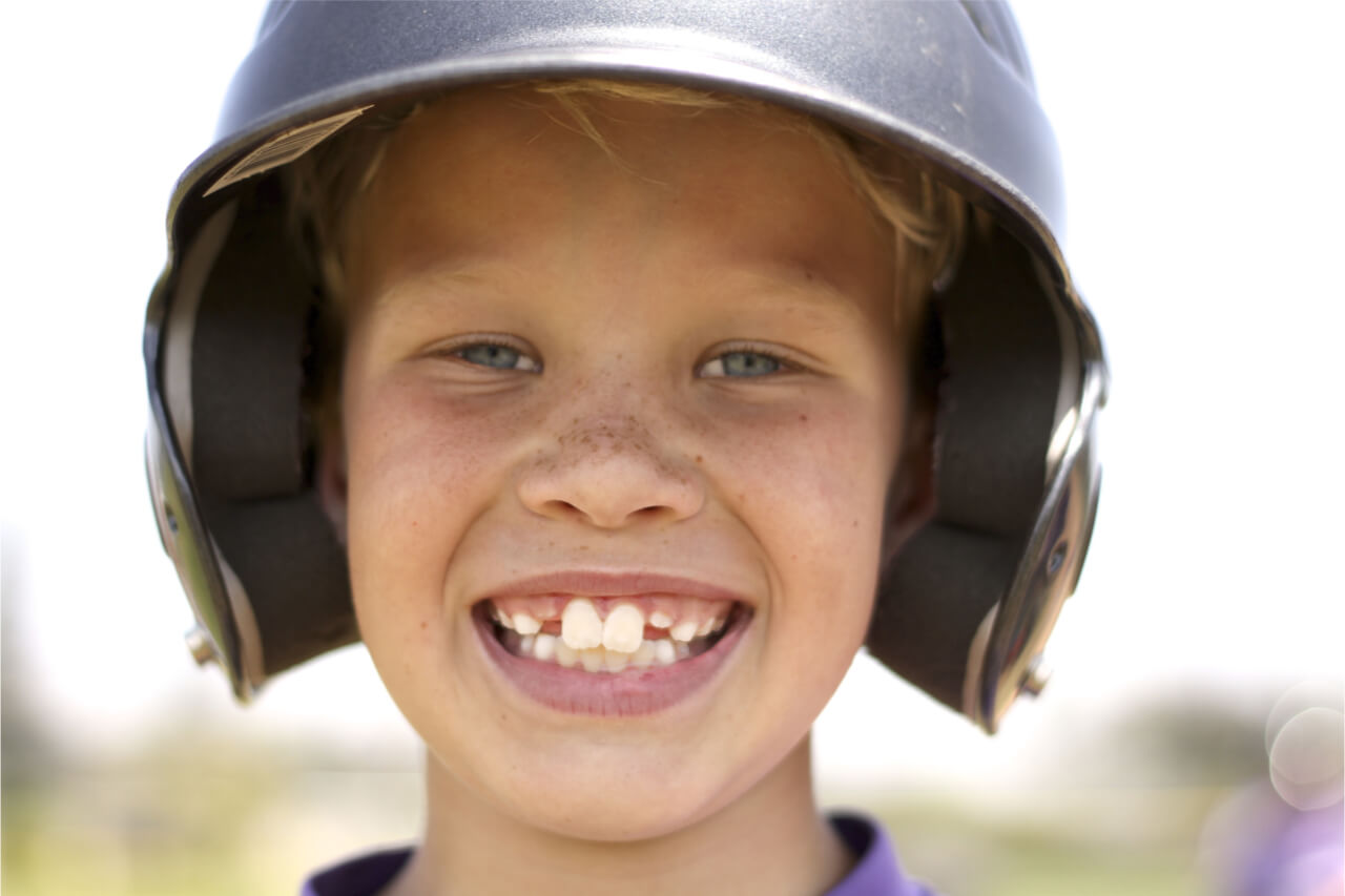 kids with buck teeth